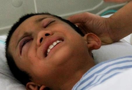 呼準公路發(fā)生校車被撞事故 7名學生受傷 呼準公路發(fā)生校車被撞事故 7名學生受傷