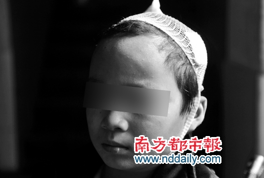 中山：兩校車相撞一學(xué)生受傷